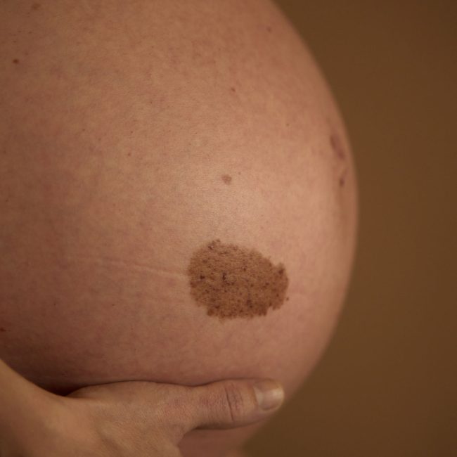 Piel y Maternidad Hero