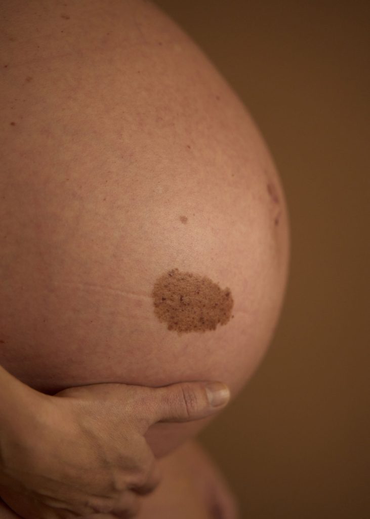 Piel y Maternidad Hero