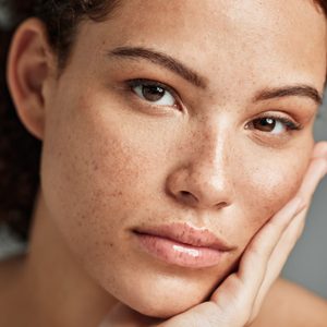 Valoración de manchas y melasma en la piel en clínica Oneskin-MED
