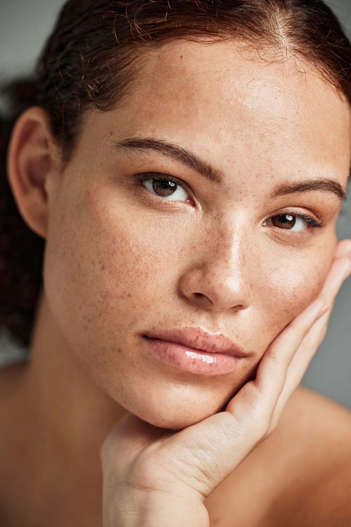 Valoración de manchas y melasma en la piel en clínica Oneskin-MED