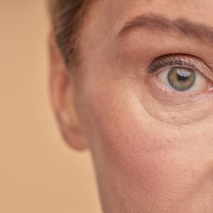 Tratamiento de polinucleótidos en contorno de ojos en clínica Oneskin-MED