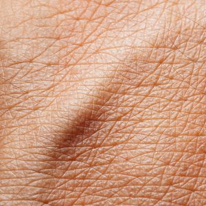 Primer plano de la textura de la piel, base de la acción de los inductores de colágeno en Oneskin-MED